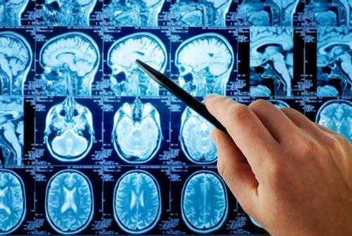 The Lexapro side effects influence several parts of the body