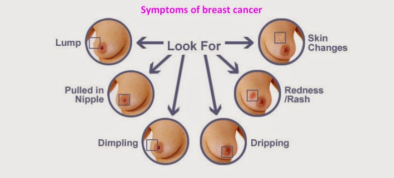 Breast Cancer 