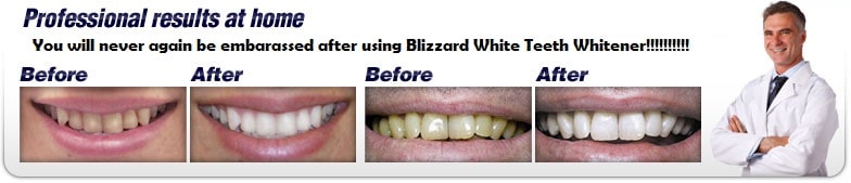 Blizzard White