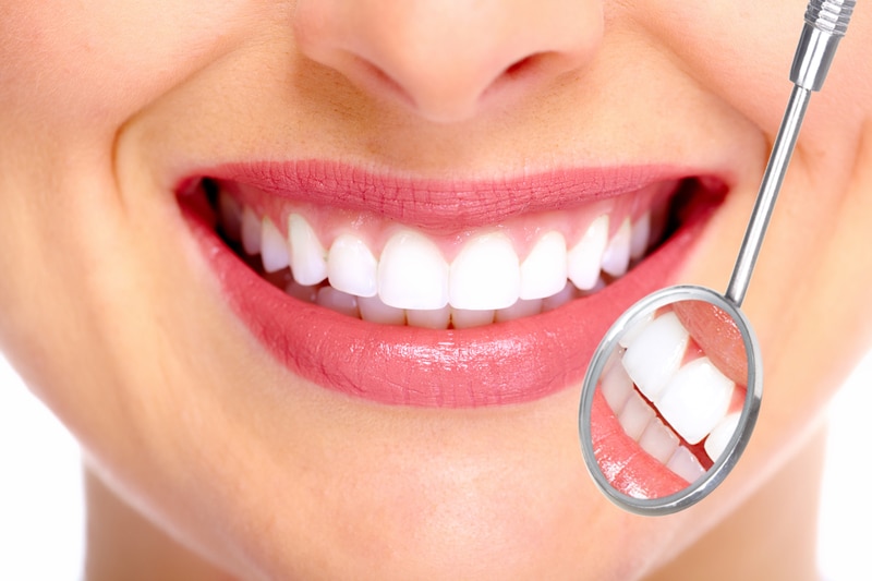 Lumi Teeth Whitening Review 