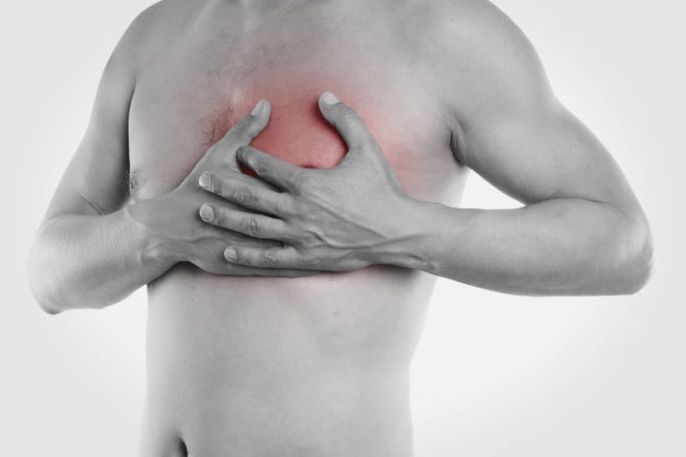 Acid reflux