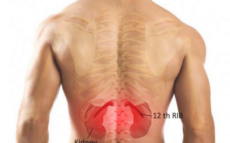 flank pain