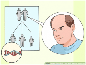 FUE Hair Transplant