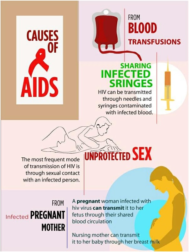 hiv aids causes