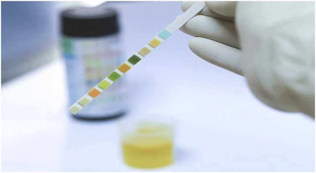 synthetic urine 
