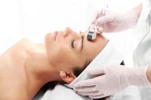 microneedling Alpharetta