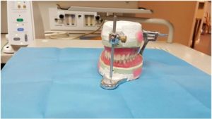 Common Dental Dentures Problems