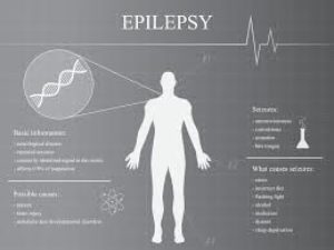 Epilepsy and Seizure Treatments