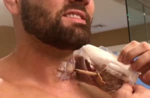 Neck Surgery