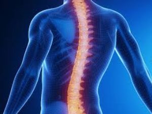Spinal Cord Stimulation