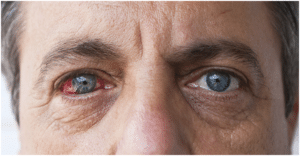 Diabetic Eye Exams