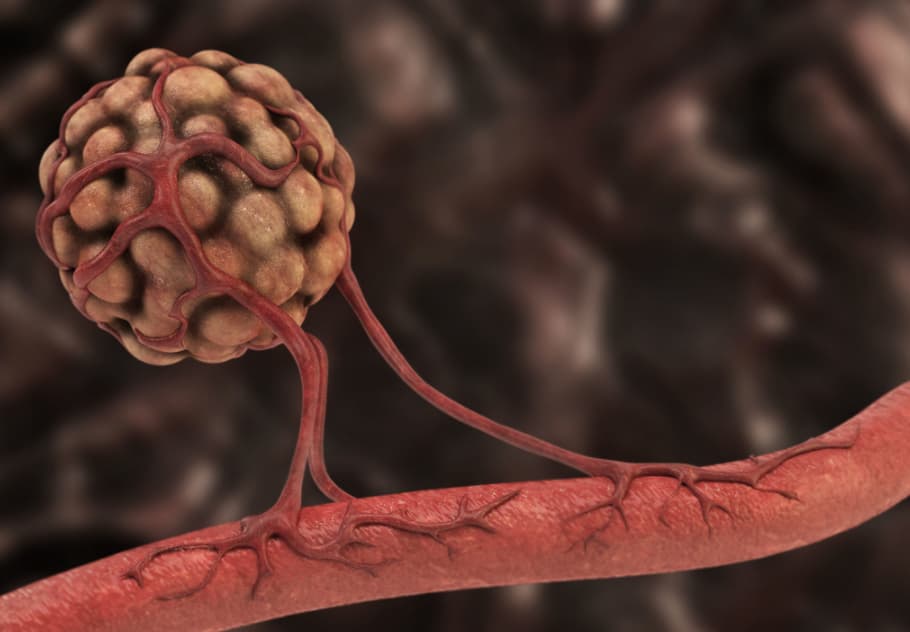30 Anti Angiogenesis Foods To Prevent Or Perhaps Cure The Cancer 30-anti-angiogenesis-foods-to-prevent-or-perhaps-cure-the-cancer