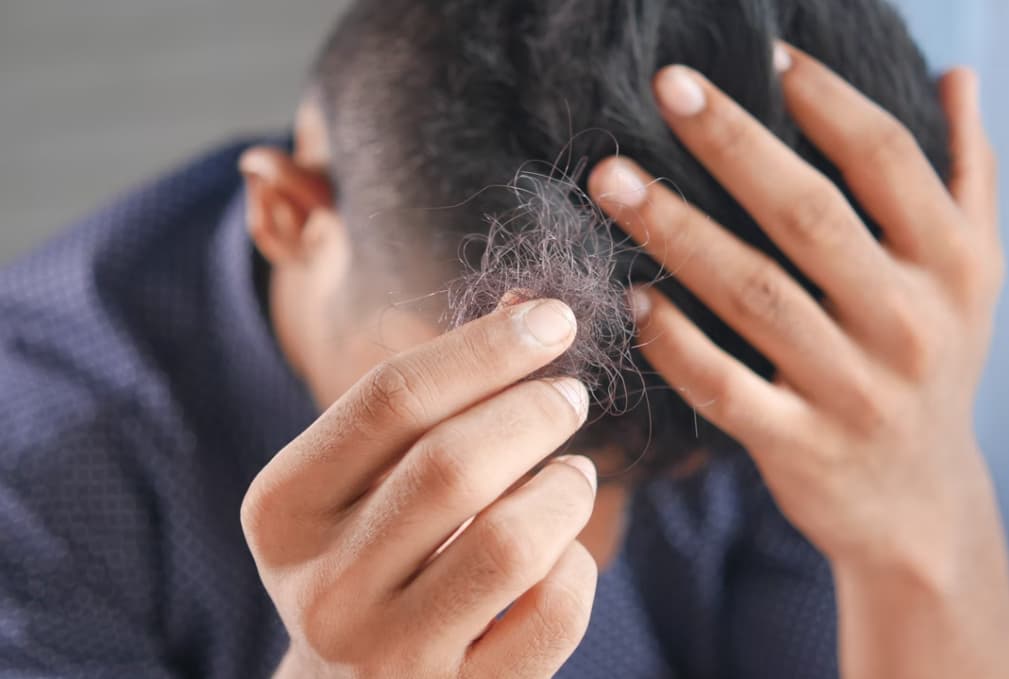 Wearing Hat After Hair Transplant