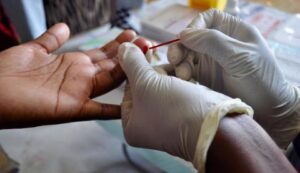 test for HIV