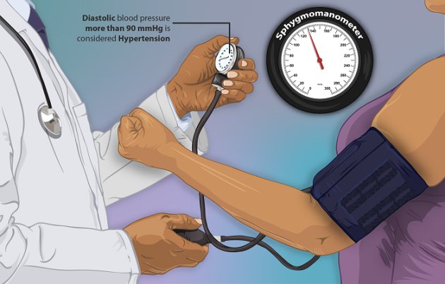 Types of Food Meant to Manage Hypertension