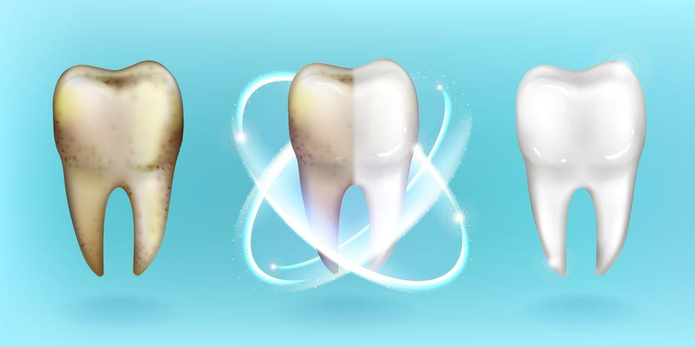 Best Root Canal Specialist in NYC 