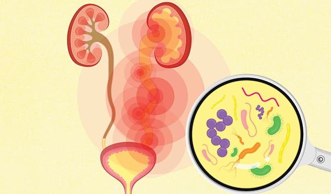 The Role of Diet in Preventing and Treating UTIs
