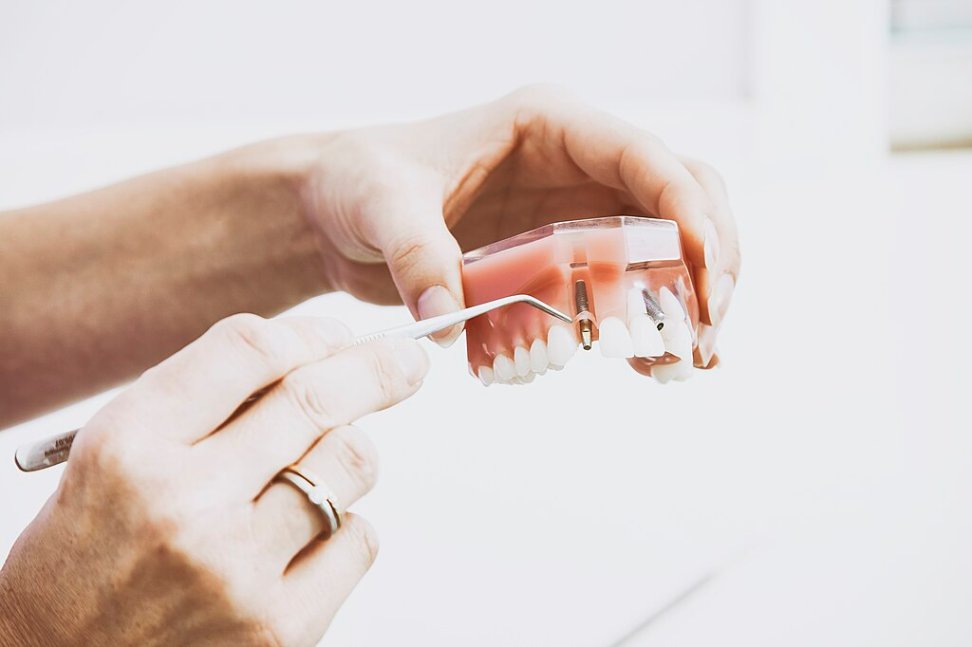 Dental Implant Solutions