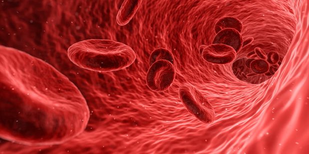 Blood Flow Restriction Training 