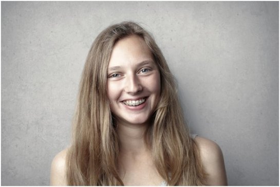 Benefits of Early Orthodontic Treatment