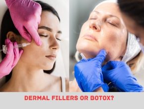 Dermal Fillers Or Botox