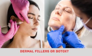 Dermal Fillers Or Botox