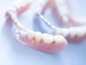 Dentures in Improving Oral Health