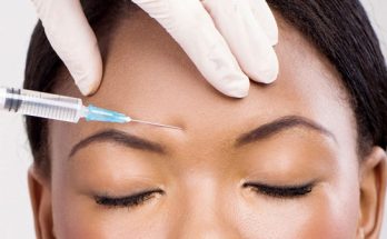 Botox and Millennials