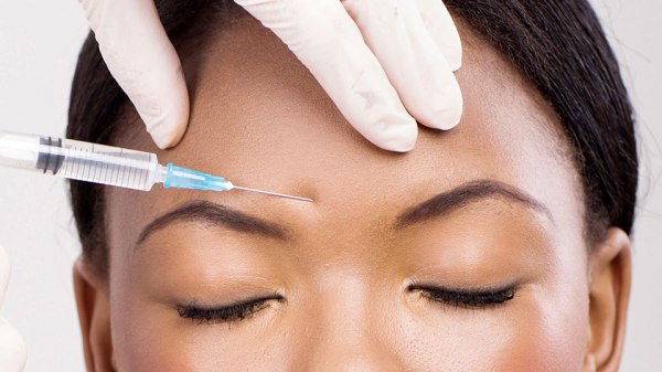 Botox and Millennials