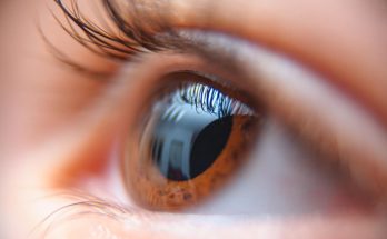 Managing Retinal Diseases