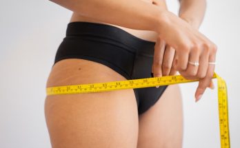 Non-Surgical Weight Loss Solutions