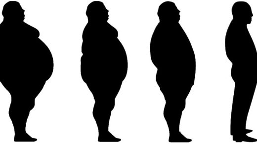 Diet Progression After Bariatric Surgery