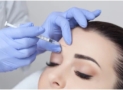 The Uses and Benefits of Botox You May Not Know