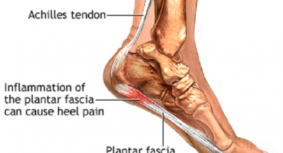 Choosing the best foot massager for plantar fasciitis