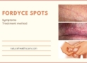 Fordyce Spots Skin Problem Symptoms and Treatment Methods