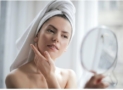 How to Reduce the Effects of Hyperpigmentation