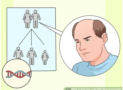 Hair Transplant India