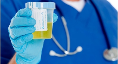 How to Use Best Synthetic Urine Called Upass to Pass Urine Drug Tests