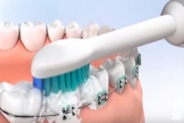 Benefits of Electric Toothbrush