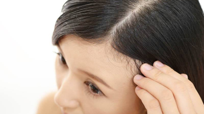 HAIR TREATMENTS TO PREVENT HAIR LOSS