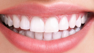 Cosmetic Dentistry Options for Tooth Whitening