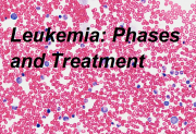 Leukemia: Phases and Treatment